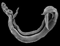 Schistosomes which cause schistosomiasis